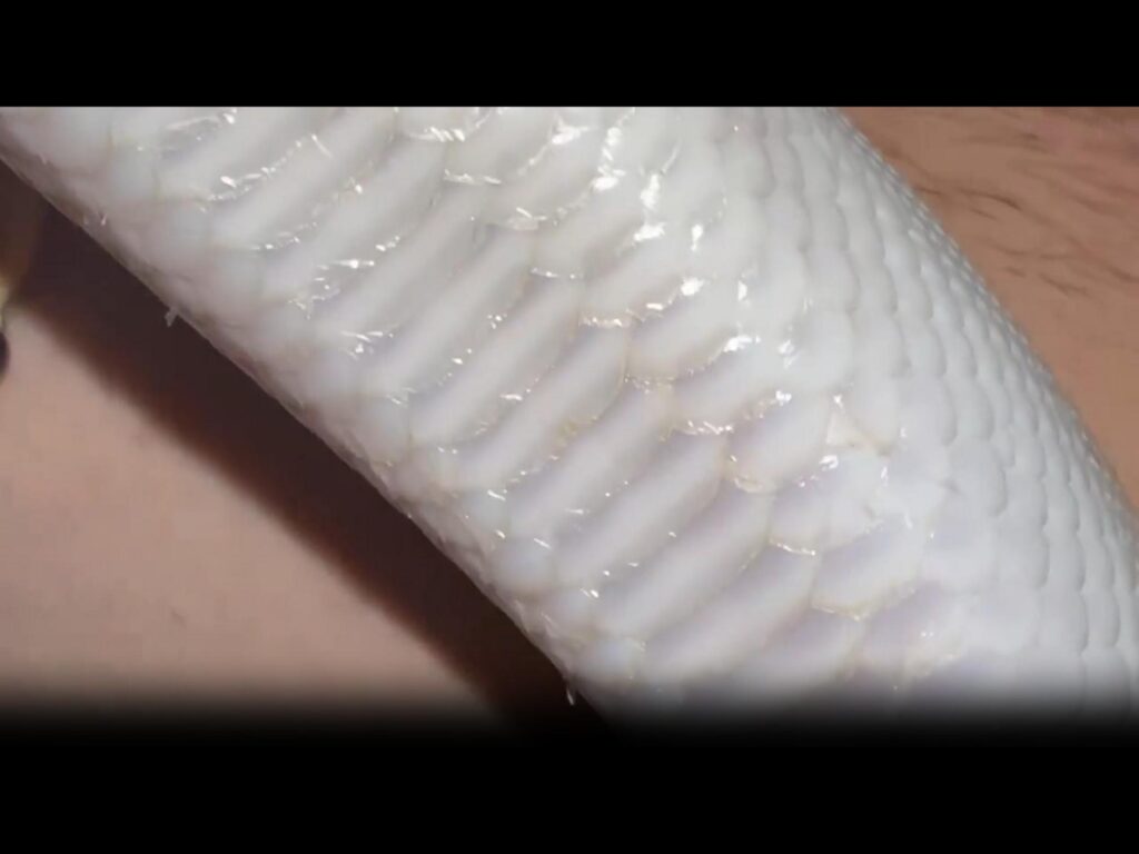 肌の上を移動する白いヘビ